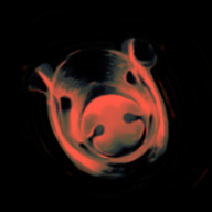 Spirkaa